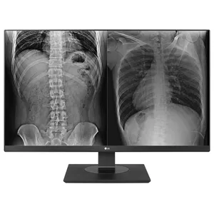 [MONLGX27HJ713CB] MONITOR LG 27INC. 27HJ713C-B IPS 8MP CLINICAL NEGRO